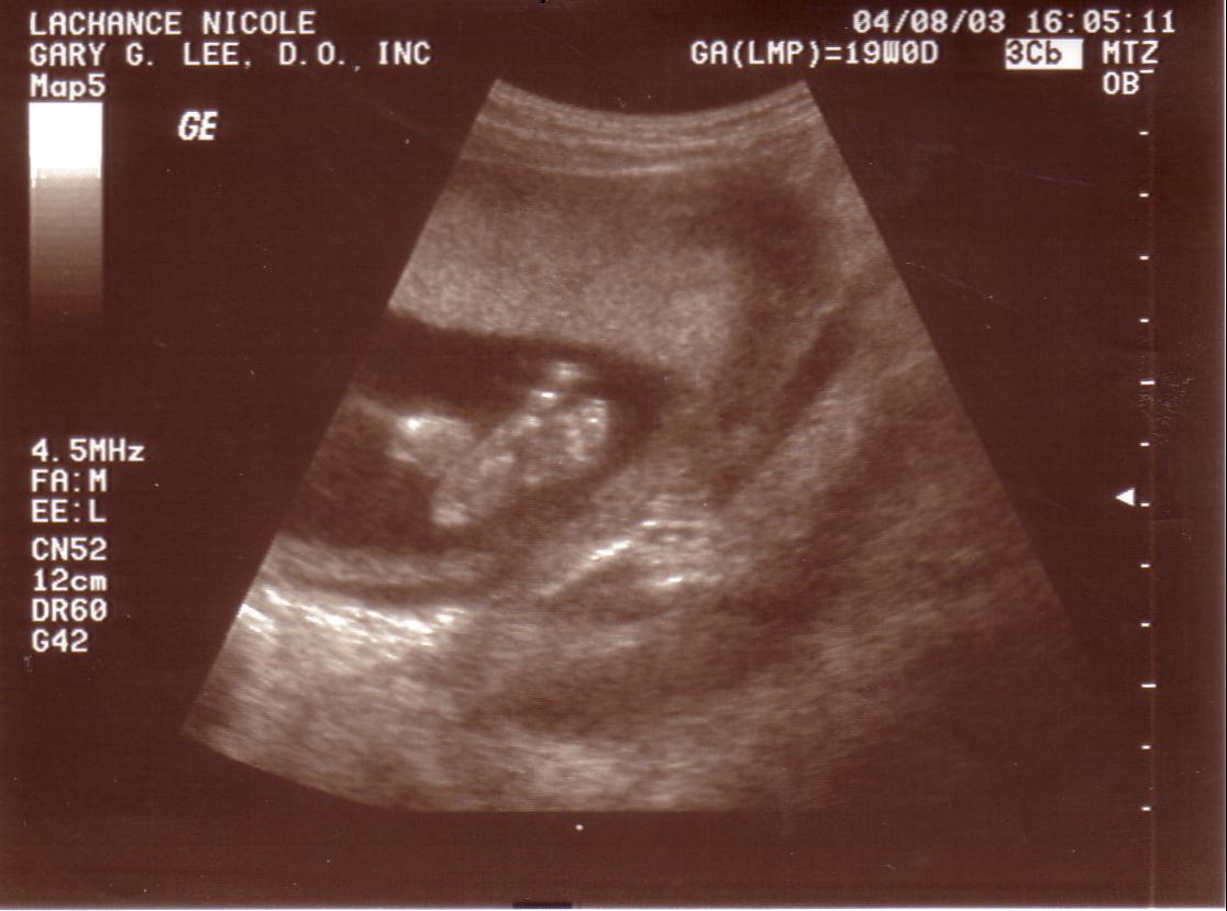 ultrasound5.jpg